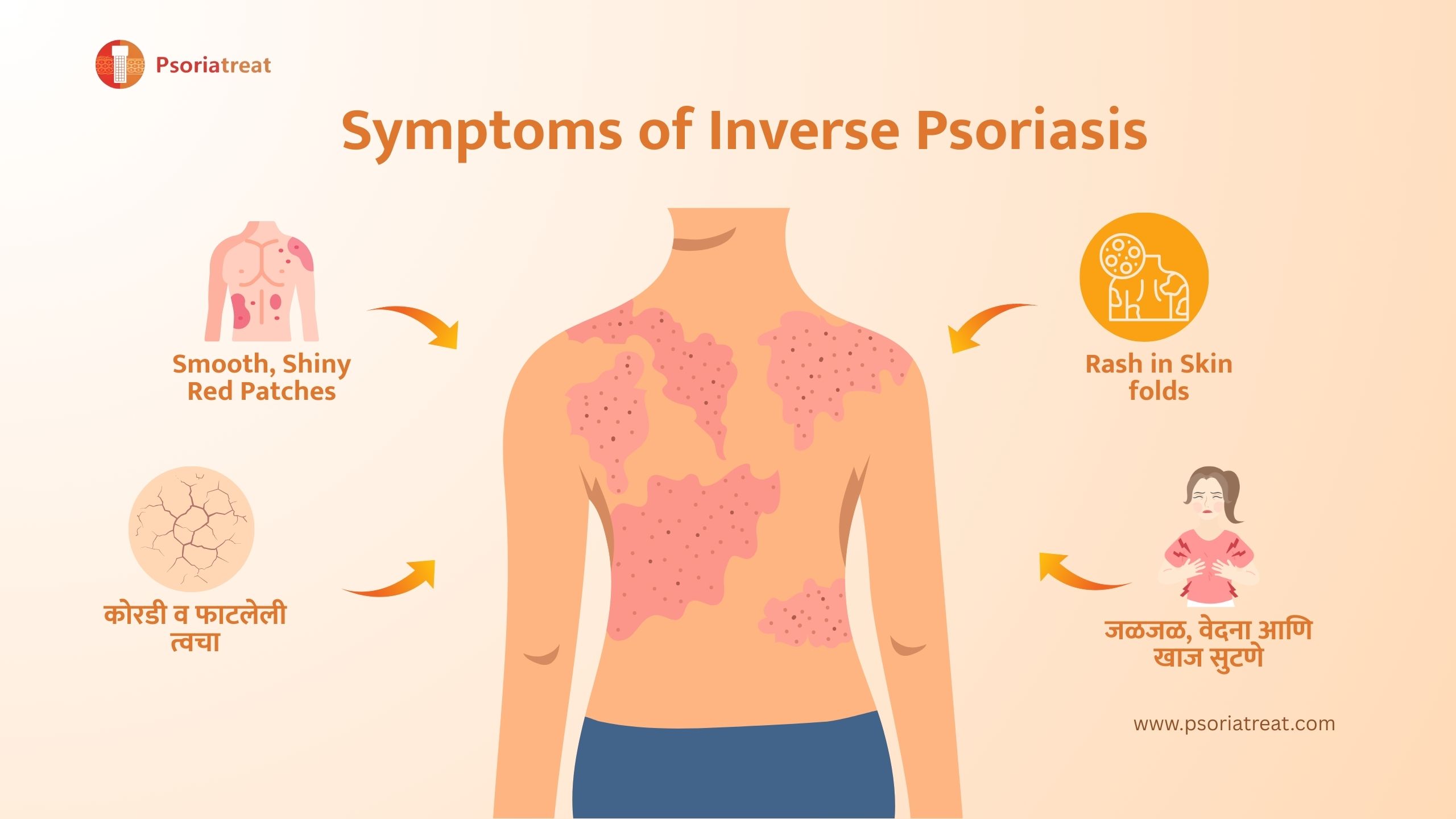 Inverse Psoriasis 1 Inverse Psoriasis 1