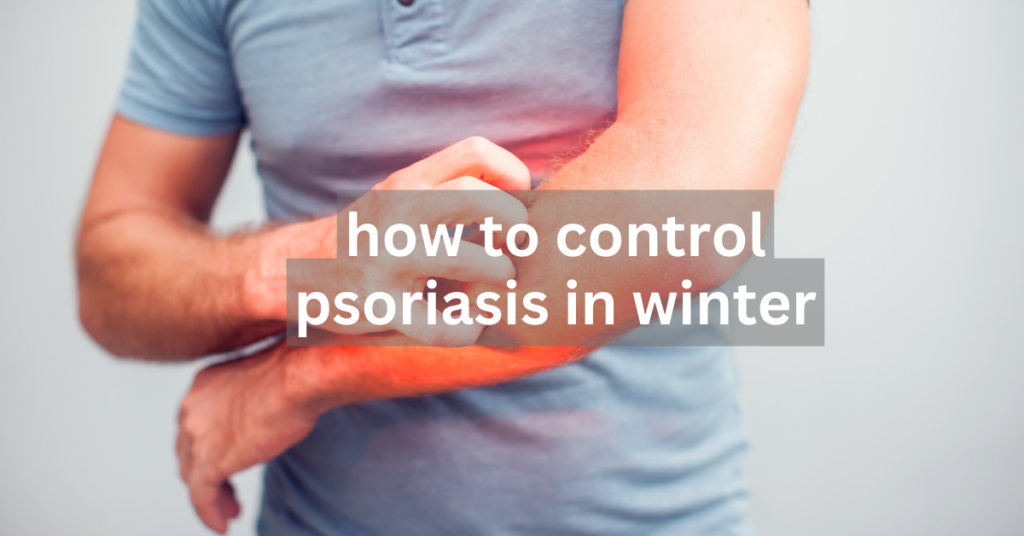 how to control psoriasis in winter