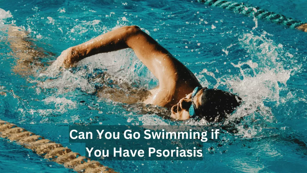 can i go swimming with psoriasis