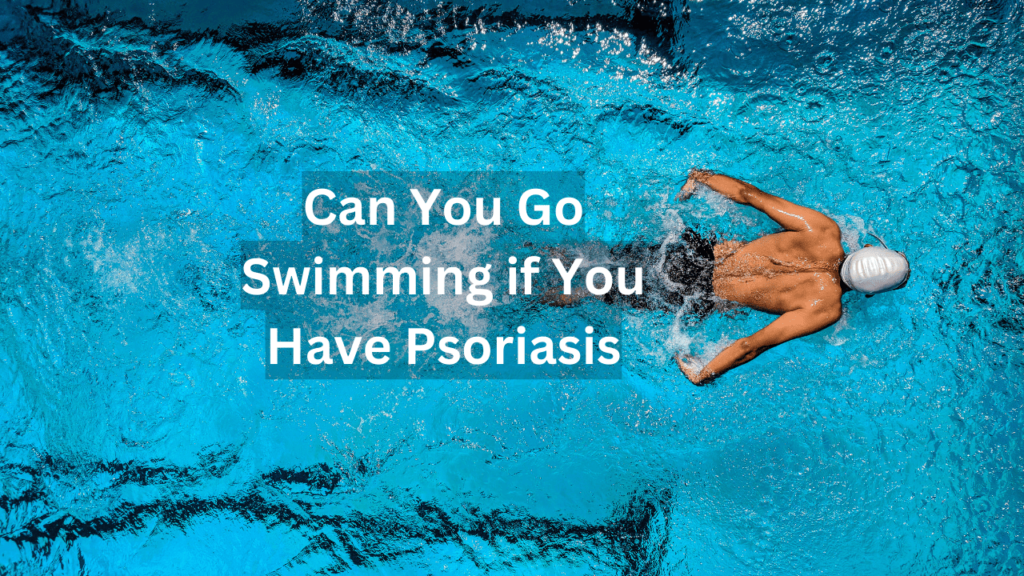 can you go swimming if you have psoriasis