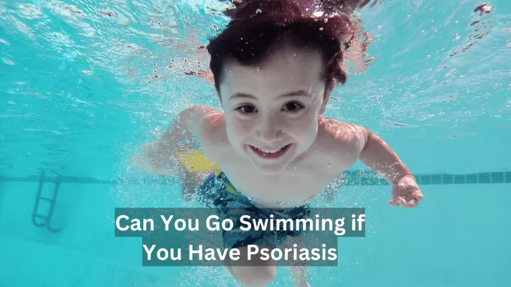 can you go swimming if you have psoriasis