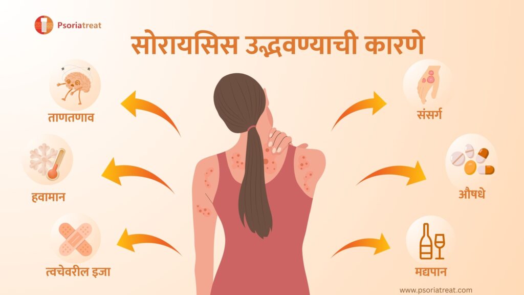 सोरियासिस म्हणजे काय मराठी अर्थ: लक्षणे, कारणे आणि होमिओपॅथिक उपाय 1