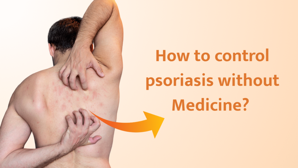 How to control psoriasis without Medicine? Is it possible?