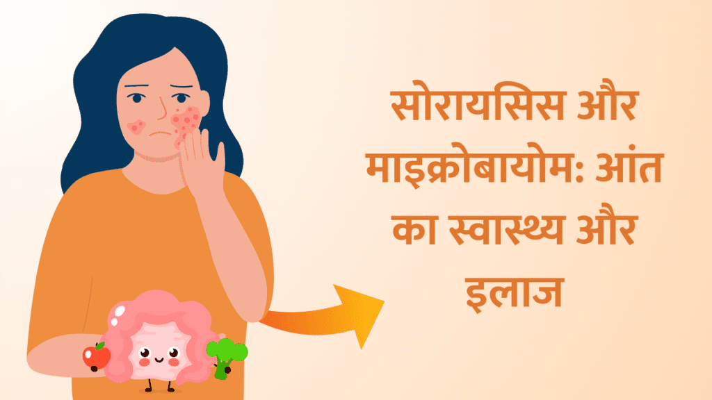 सोरायसिस और माइक्रोबायोम