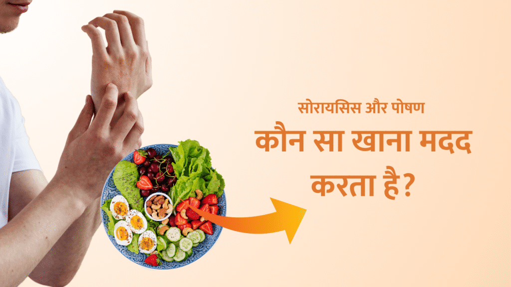 सोरायसिस और पोषण