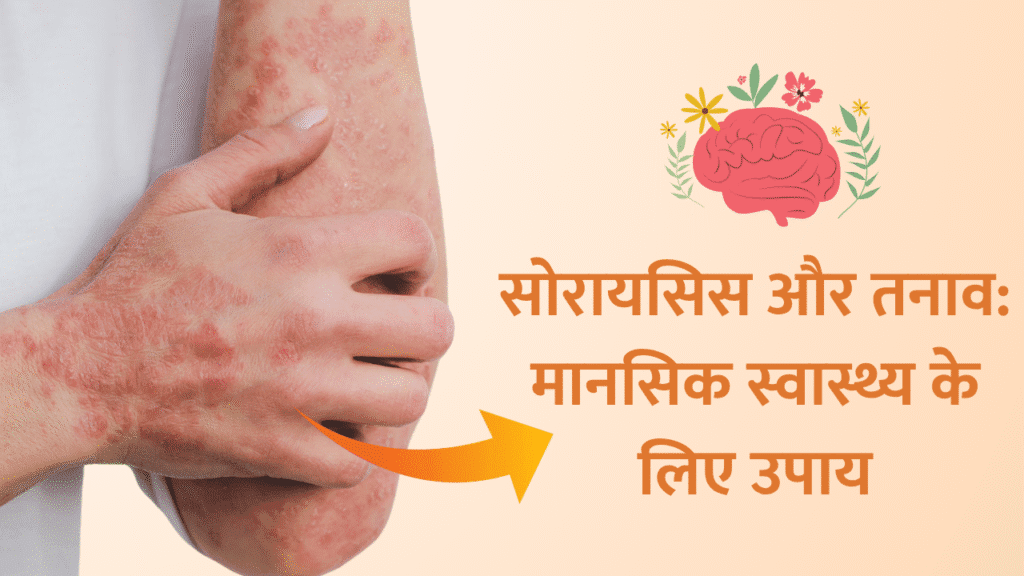 सोरायसिस और तनाव