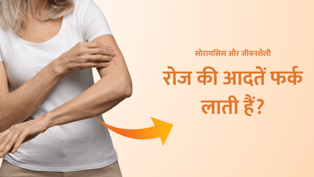 सोरायसिस और जीवनशैली: रोज की आदतें फर्क लाती हैं? | Psoriasis and Lifestyle: Do Daily Habits Help? 1 Psoriasis and Lifestyle