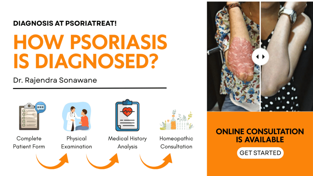 How Is Psoriasis Diagnosed? Psoriatreat’s Homoeopathic Process 1 How Is Psoriasis Diagnosed?