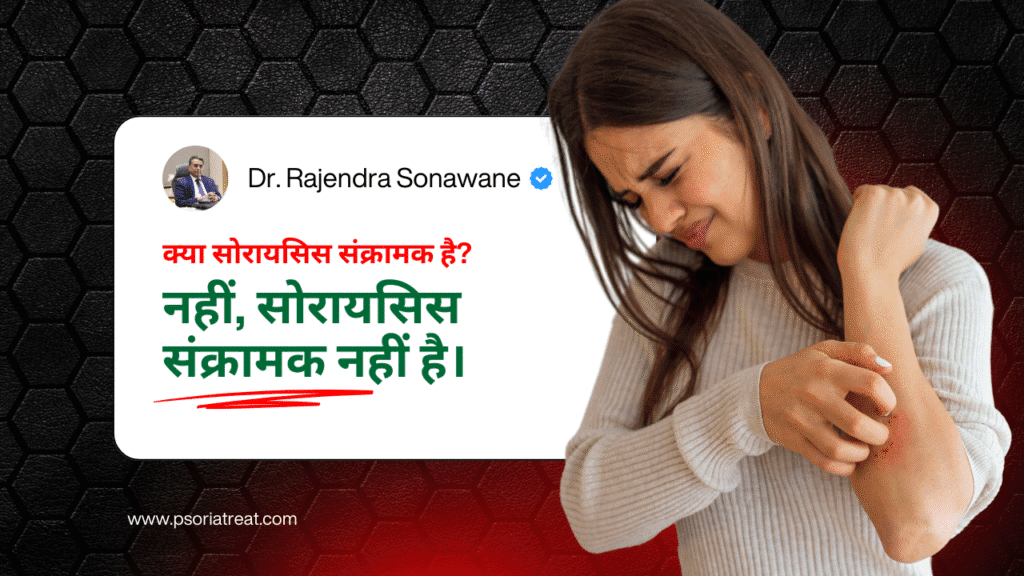 सोरायसिस संसर्गजन्य आहे का?