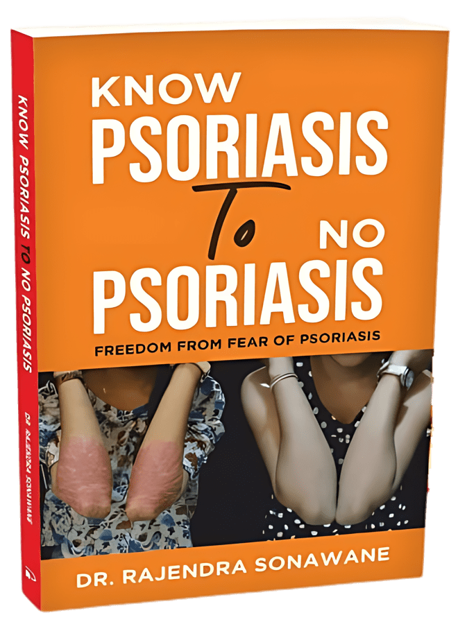 Know Psoriasis to no Psoriasis