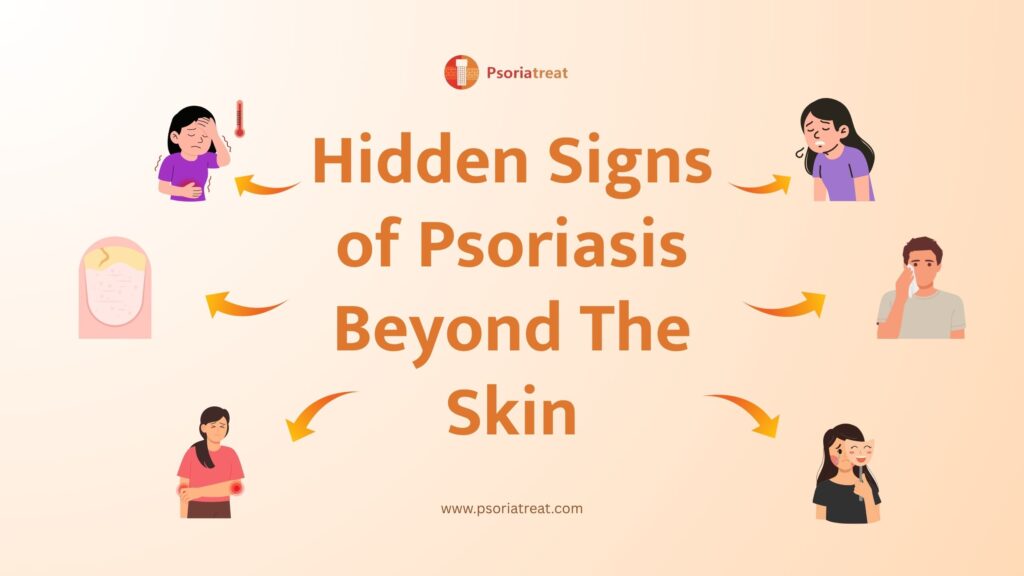 Hidden signs of Psoriasis beyond the skin 1 Hidden signs of Psoriasis beyond the skin