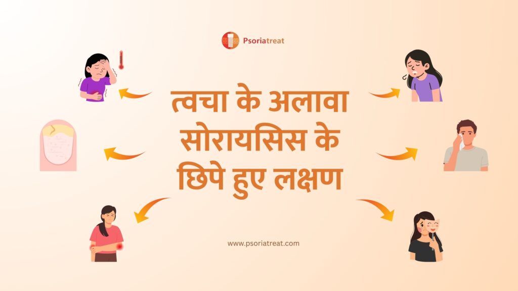 त्वचा के अलावा सोरायसिस के छिपे हुए लक्षण - Hidden signs of Psoriasis beyond the skin in hindi 1 त्वचा के अलावा सोरायसिस के छिपे हुए लक्षण