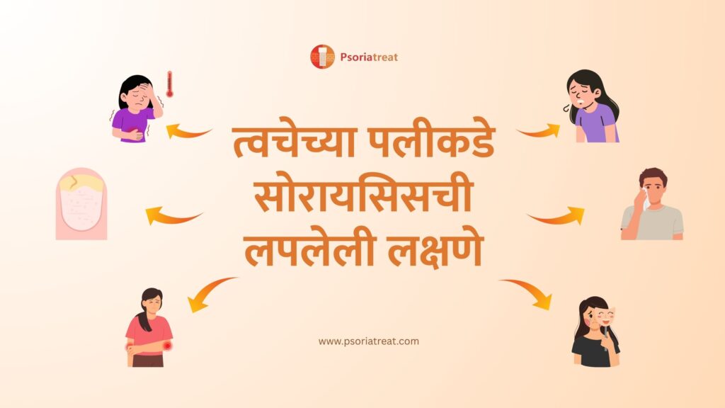त्वचेच्या पलीकडे सोरायसिसची लपलेली लक्षणे - Hidden signs of Psoriasis beyond the skin in Marathi 1 त्वचेच्या पलीकडे सोरायसिसची लपलेली लक्षणे
