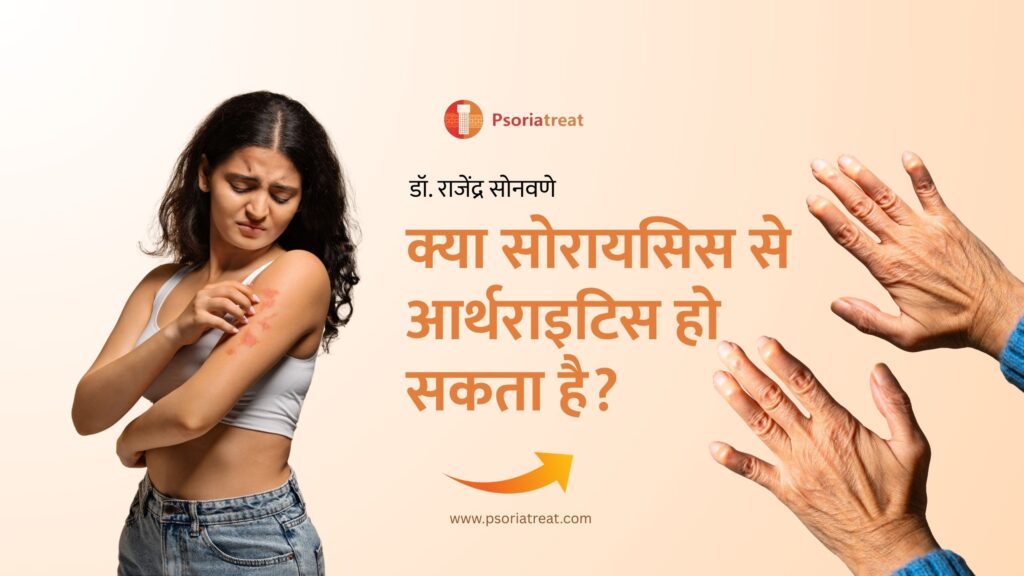 क्या सोरायसिस से आर्थराइटिस हो सकता है? - Can psoriasis cause arthritis? in Hindi 1 क्या सोरायसिस से आर्थराइटिस हो सकता है?