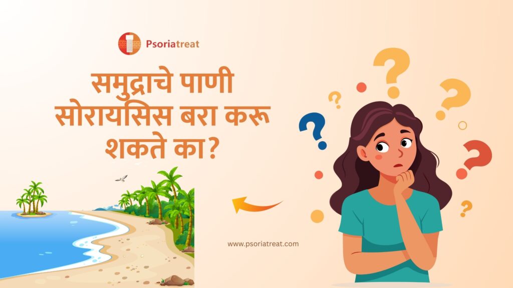 समुद्राचे पाणी सोरायसिस बरा करू शकते का? - Can Sea Water Cure Psoriasis? in Marathi 1 समुद्राचे पाणी सोरायसिस बरा करू शकते का