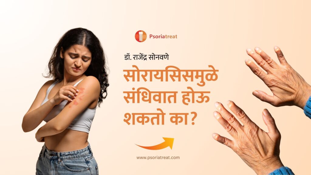 सोरायसिसमुळे संधिवात होऊ शकते का? - Can Psoriasis cause Arthritis? in Marathi. 1 Can Psoriasis cause Arthritis? in Marathi.