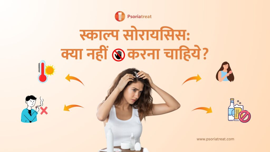 स्काल्प सोरायसिस: क्या नहीं करना चाहिए? - Scalp Psoriasis: What not to do? in Hindi 1 स्काल्प सोरायसिस: क्या नहीं करना चाहिए?