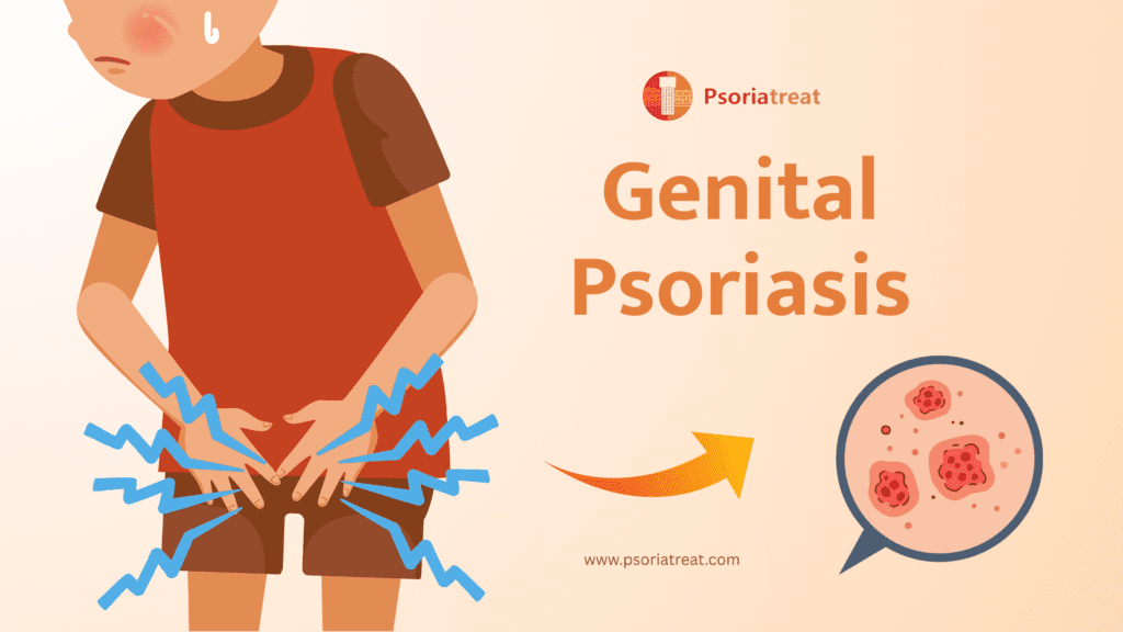 What is Genital Psoriasis?