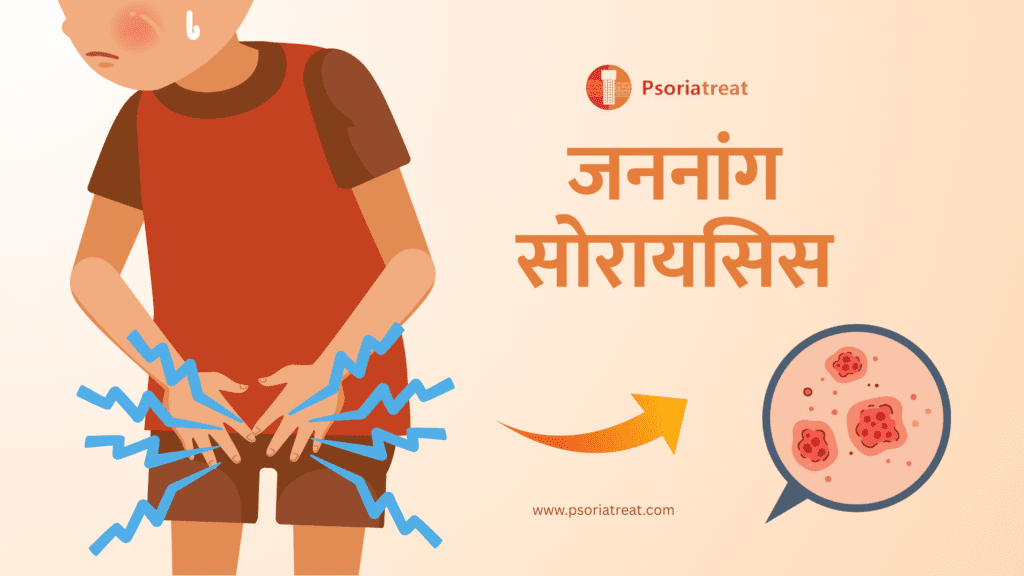 जननांग सोरायसिस क्या है, इसके लक्षण और इलाज क्या हैं