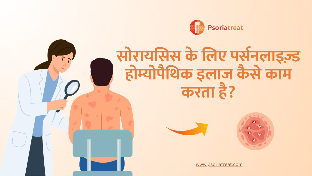 How does personalised homoeopathic treatment for psoriasis work? in hindi. 