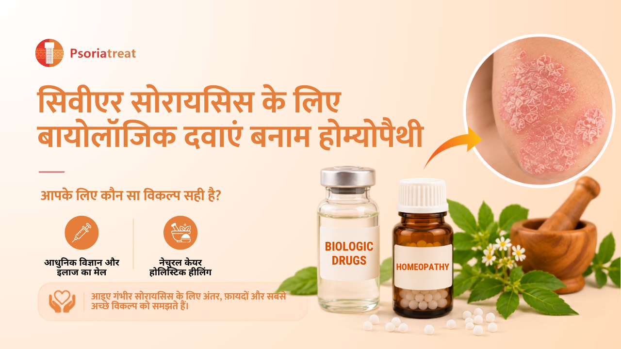 Biologic Drugs vs Homeopathy for severe psoriasis in hindi
