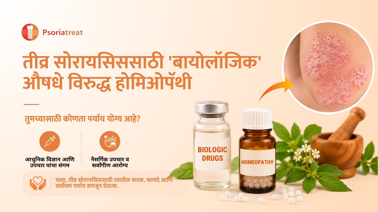 Biologic Drugs vs Homeopathy for severe psoriasis in marathi