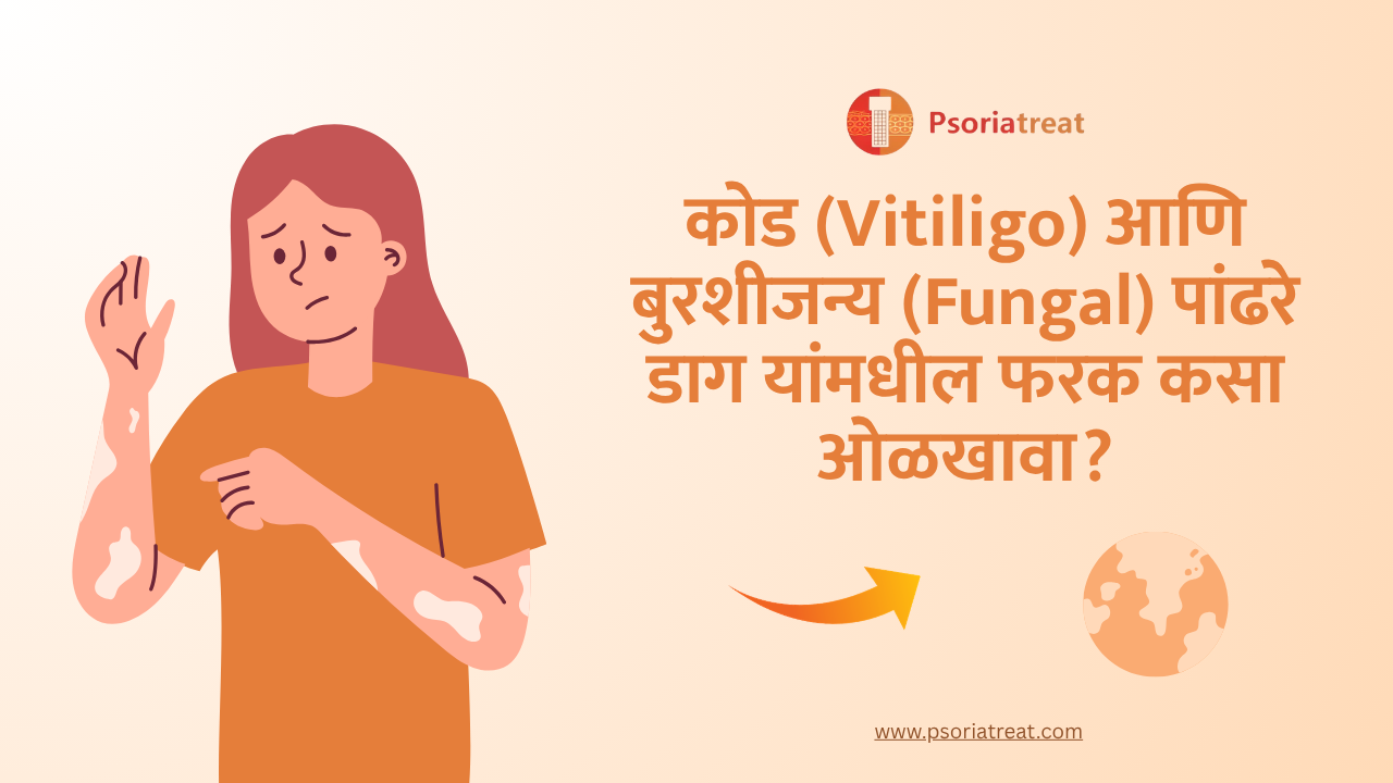 How to tell the difference between vitiligo & fungal white patches in marathi