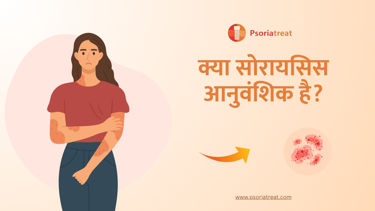 Is psoriasis genetic in hindi