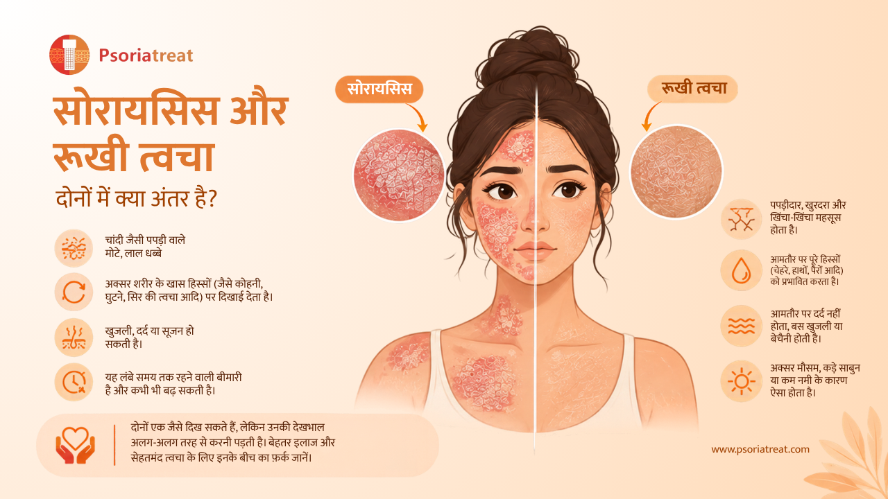 Psoriasis vs Dry Skin How Are They Different in hindi