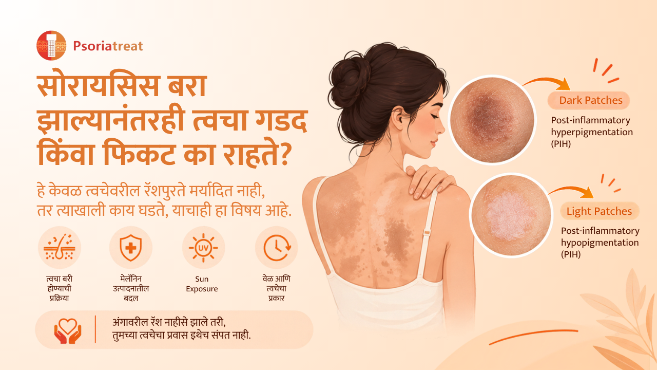 Why Does Skin Stay Dark or Light After Psoriasis Clears in marathi