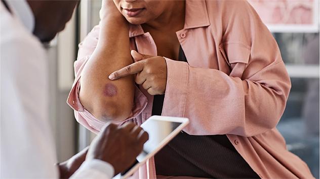 सोरायसिस या फिर एक्झिमा? | Key difference between Psoriasis and Eczema in Hindi 2 Types of Psoriasis