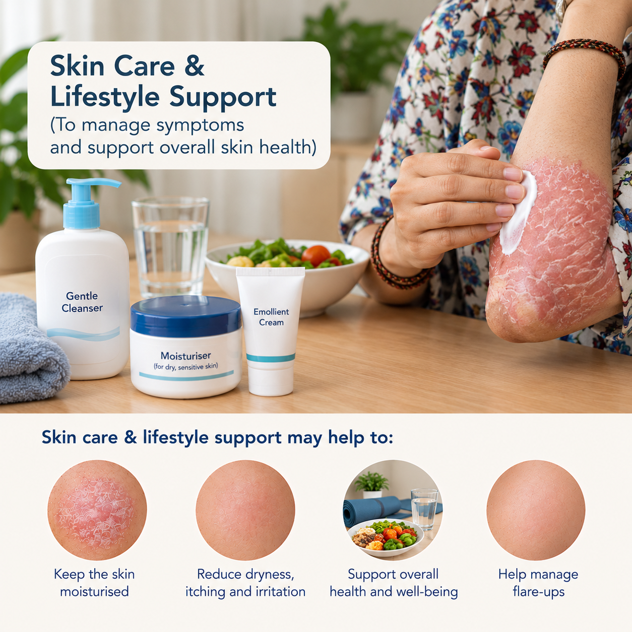 Psoriasis Treatment 5