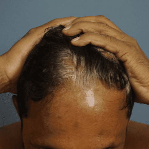 Home 1